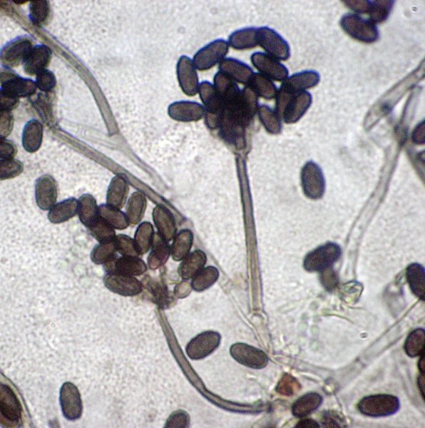 Stachybotrys - black mold